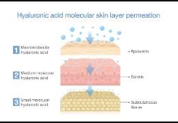 如何選擇適合油痘肌的精華產(chǎn)品？